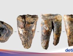 Studi Ungkap Bukti Praktik Perawatan Medis Gigi Tertua, Berusia 59 Ribu Tahun