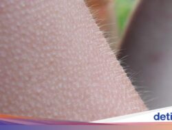 Terungkap! Ternyata Ini Alasan Manusia Bisa Merinding Menurut Ahli Biologi